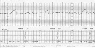 Ultrasonography in Biophysical Profile: Practice Essentials.